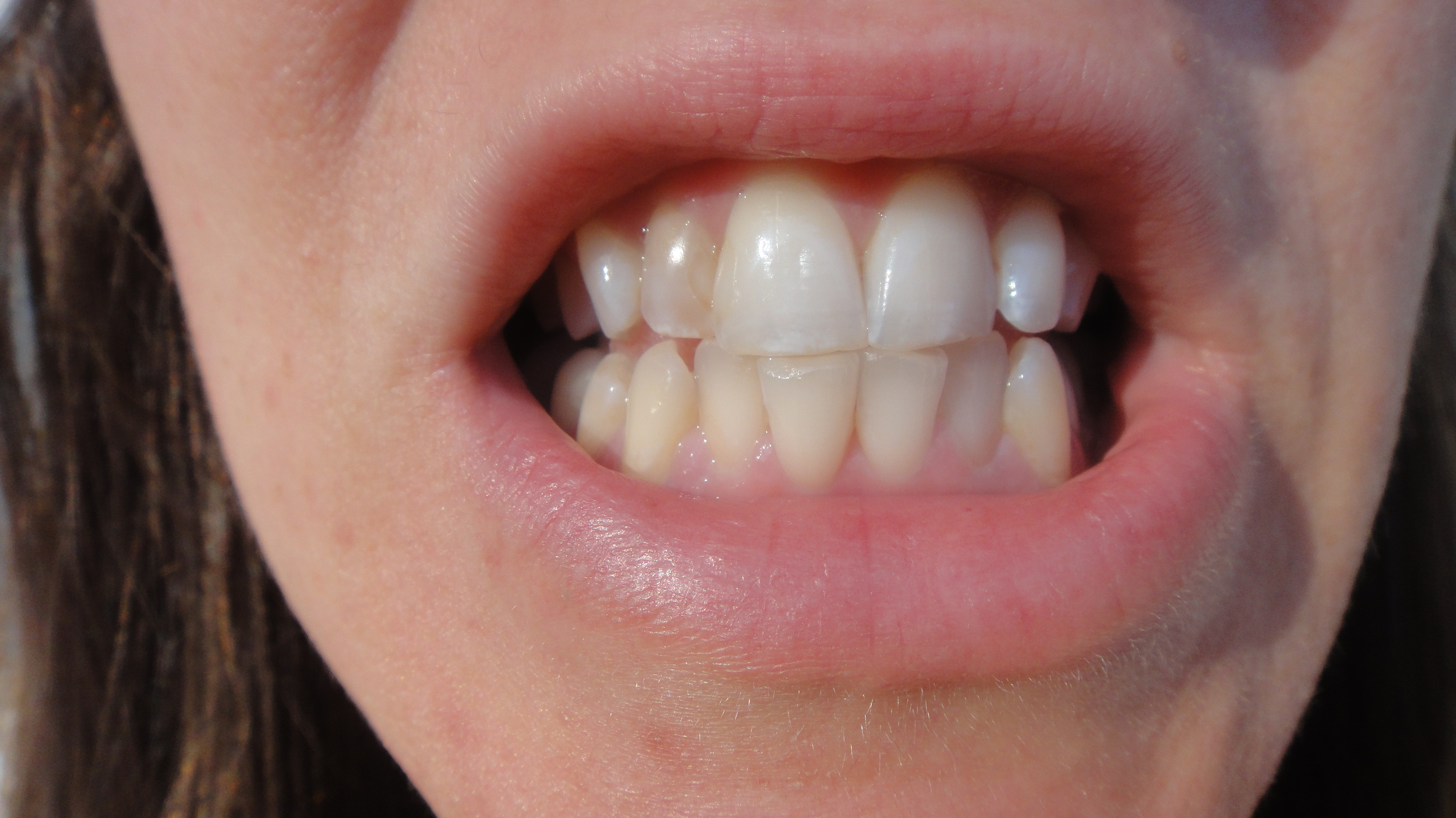 Why Oil Pulling is a Load of CrapThe Luxury Spot